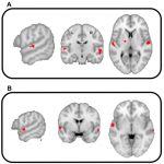 The Science Behind Hating Someone For Their Voice