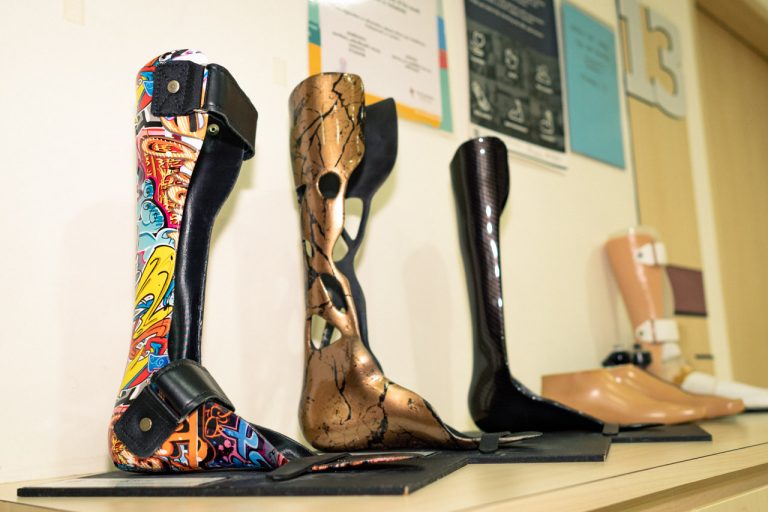 What It Takes to Rebuild Limbs and Lives for Patients