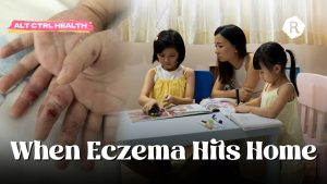 A Family’s Fight With Severe Eczema